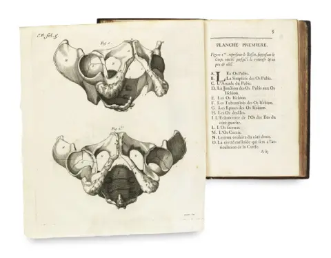 Henri-Francois Le Dran – Parallèle des différentes manières de tirer la pierre hors de la vessie