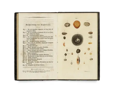 Francois Magendie – Recherches physiologiques et médicales sur le sable urinaire, ses causes, symptômes et traitement, ainsi que…