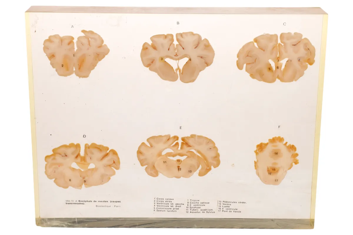Biologisches Schnittmodell ”Encephale de mouton”