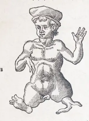 Uffenbach,P. – Thesaurus chirurgiae, continens praestantissimorum autorum opera chirurgica