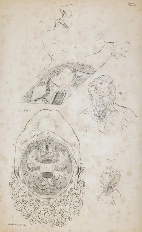 Froriep,R. – Chirurgische anatomie van de ligatuurplaatsen op het menselijk lichaam
